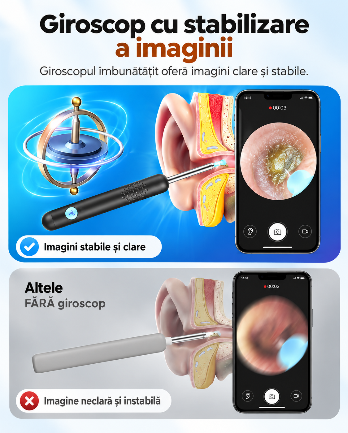 Endoscop auricular Bebird R1, cameră Wi-Fi 3MP, rezistent la apă, negru